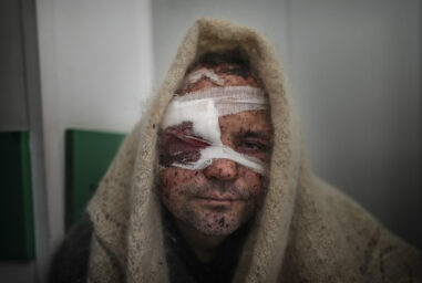 Serhiy Kralya, 41, looks at the camera after surgery at a hospital in Mariupol, eastern Ukraine on Friday, March 11, 2022. Kralya was injured during shelling by Russian forces. (AP Photo/Evgeniy Maloletka)