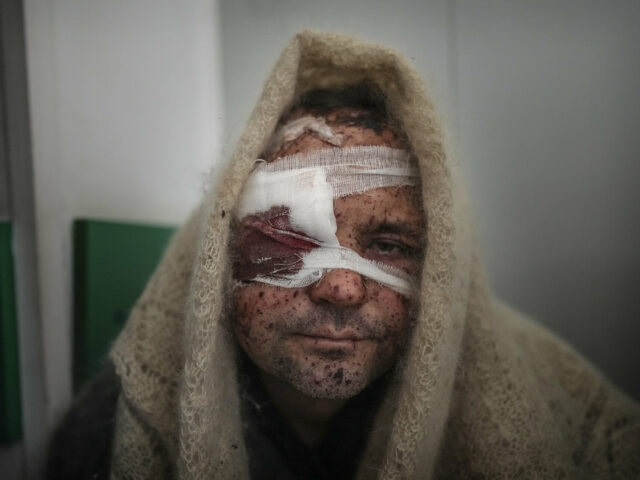 Serhiy Kralya, 41, looks at the camera after surgery at a hospital in Mariupol, eastern Ukraine on Friday, March 11, 2022. Kralya was injured during shelling by Russian forces. (AP Photo/Evgeniy Maloletka)