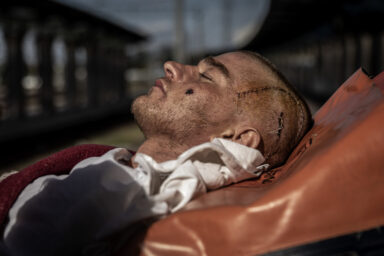 A patientswith a head wound is loaded into an Intensive Care Unit carriage of a medical evacuation train run by the medical charity Medicines San Frontiers (Doctors Without Borders), in the eastern city of Dnipro, May 20, 2022. Finbarr O???Reilly for The New York Times NYTUKRAINE